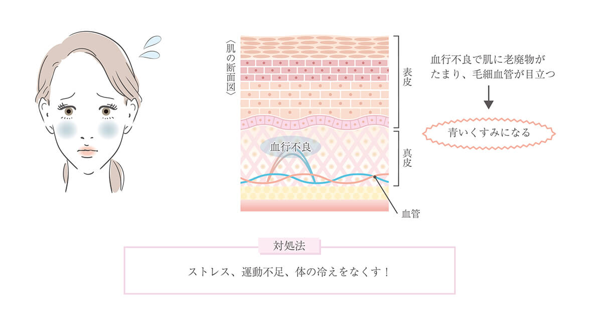 青黒いくすみ