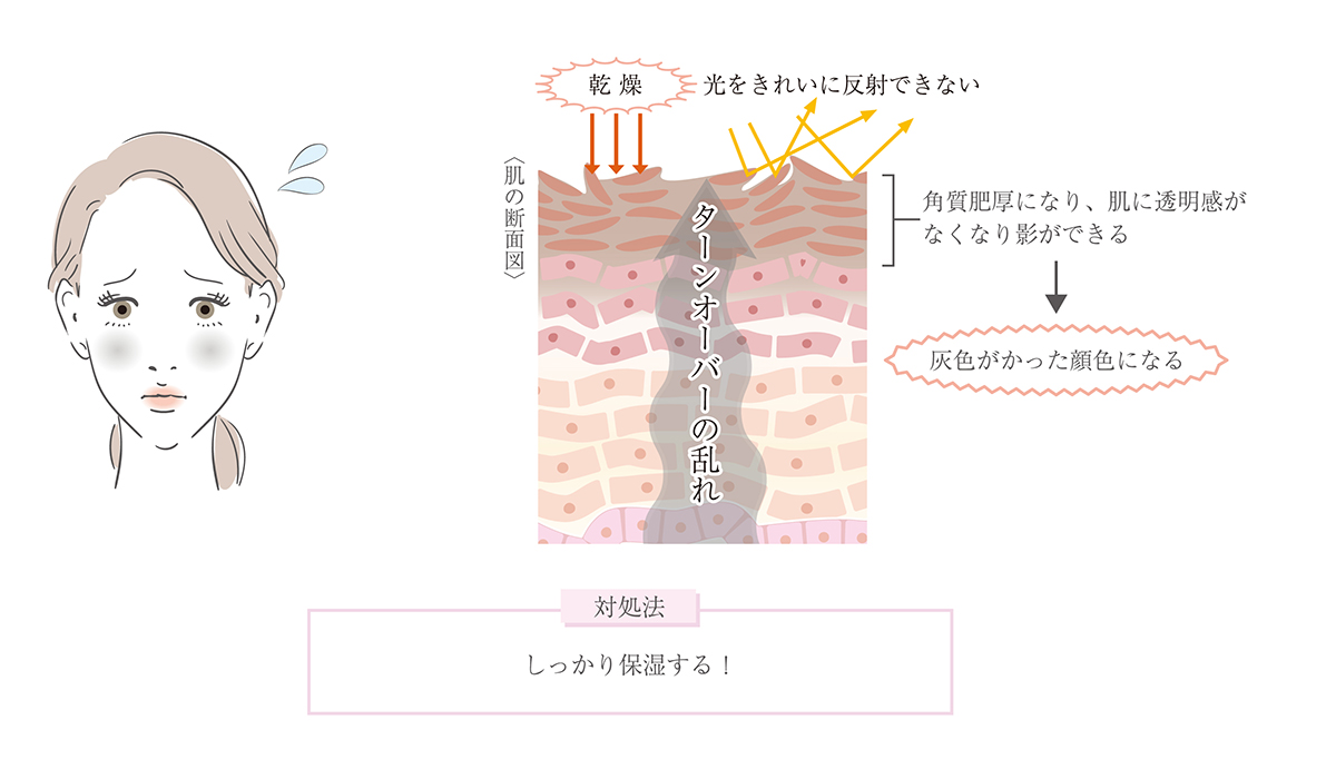 グレーのくすみ