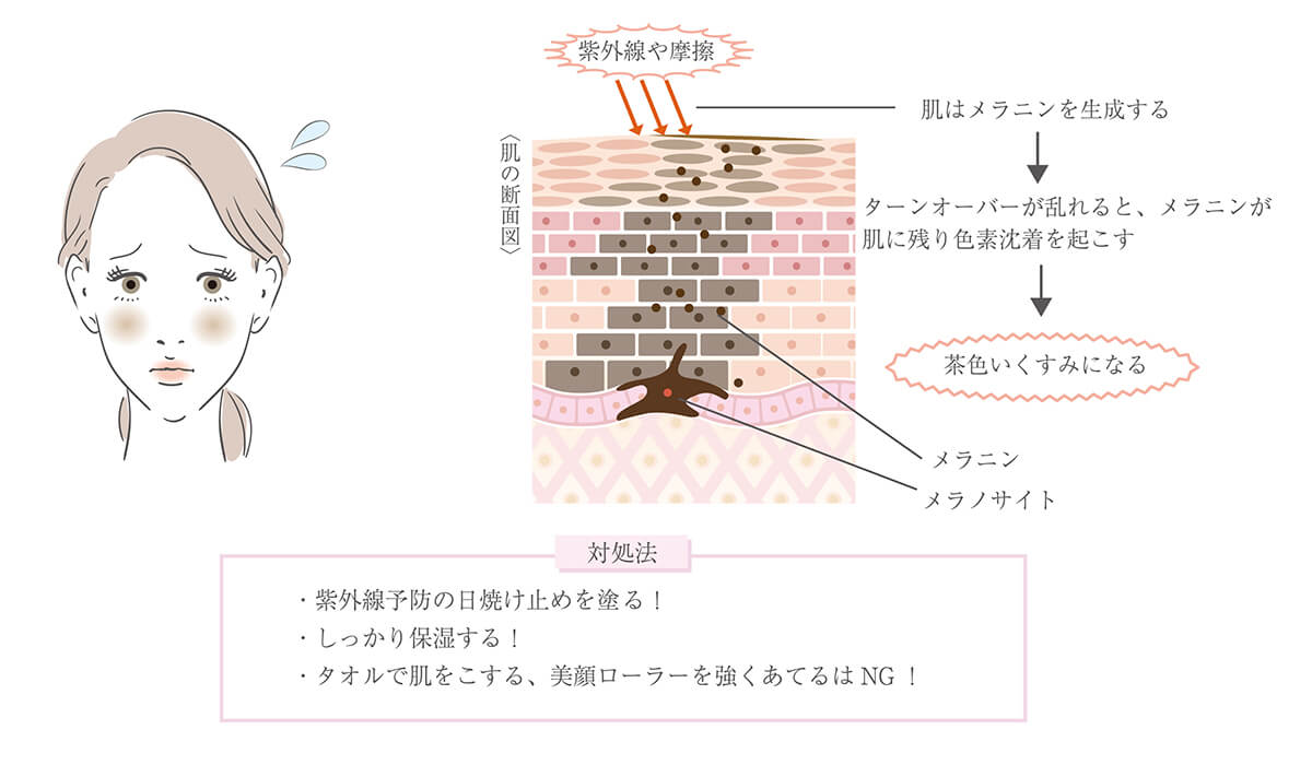 茶色いくすみ