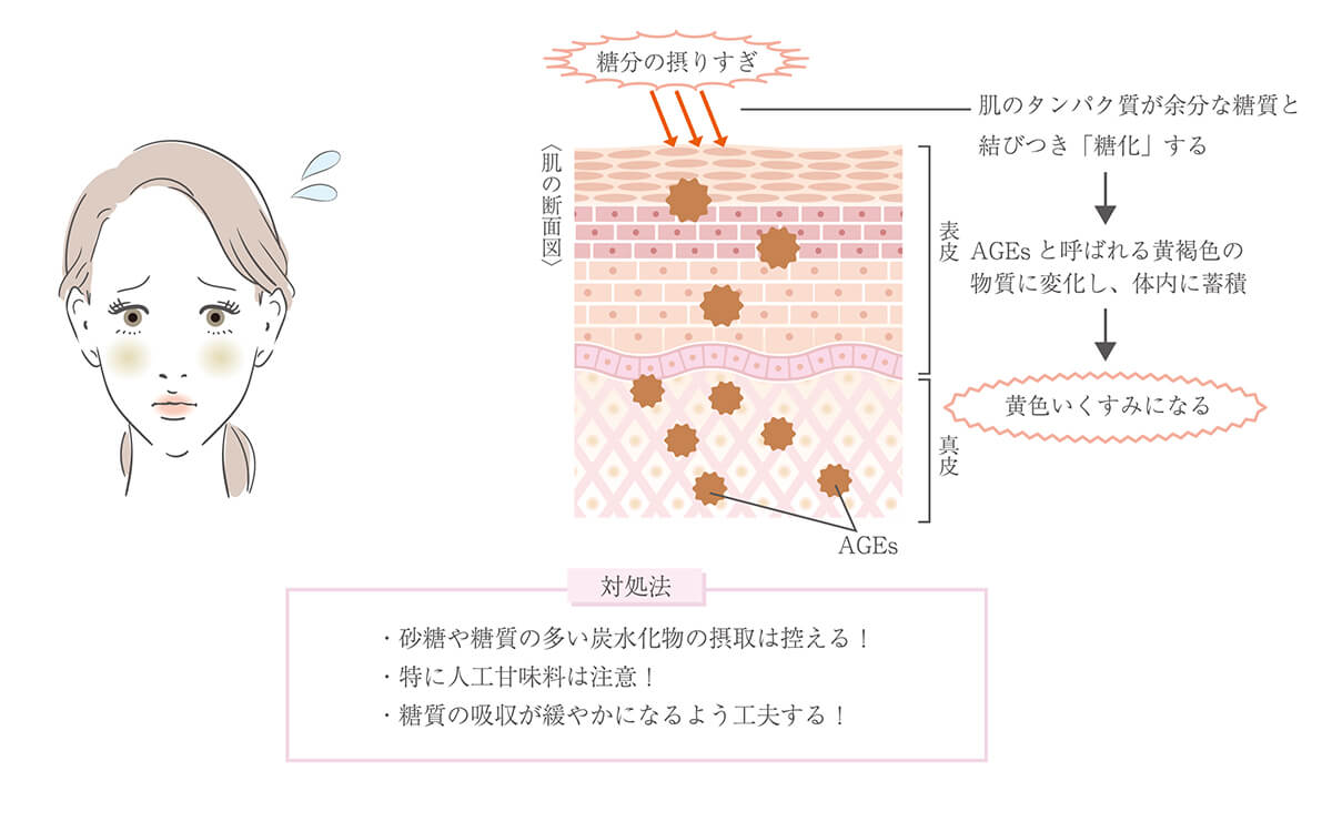 黄色のくすみ
