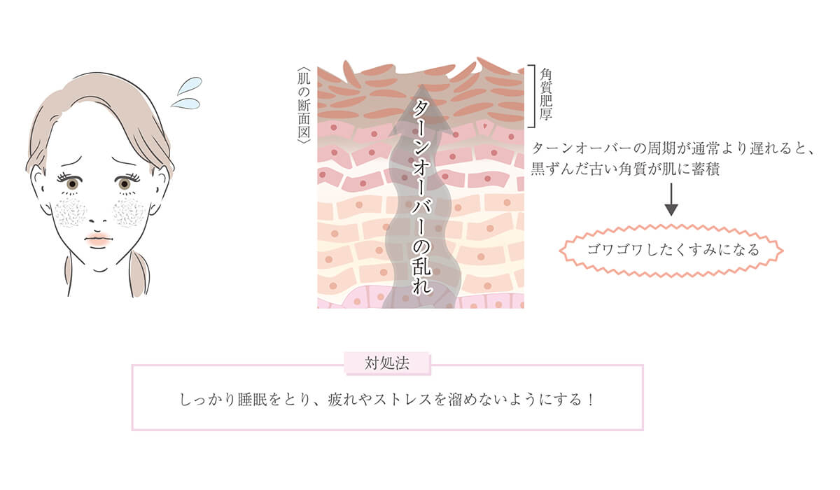 ゴワゴワしたくすみ